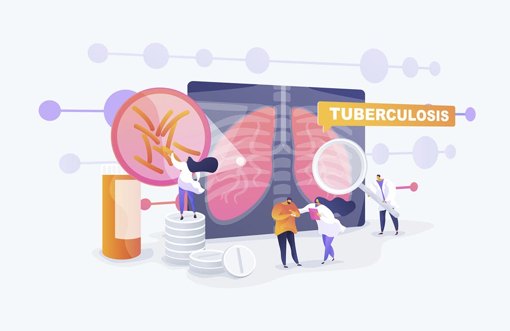 Pneumonia treatment, bronchitis cure. Respiratory contagious viral infection. Tuberculosis, mycobacterium tuberculosis, world tuberculosis day concept. Vector isolated concept creative illustration